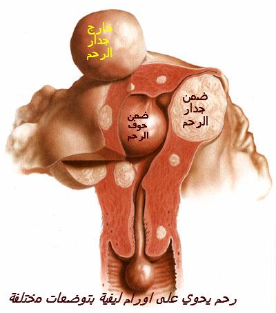 fibrom%20arab.jpg
