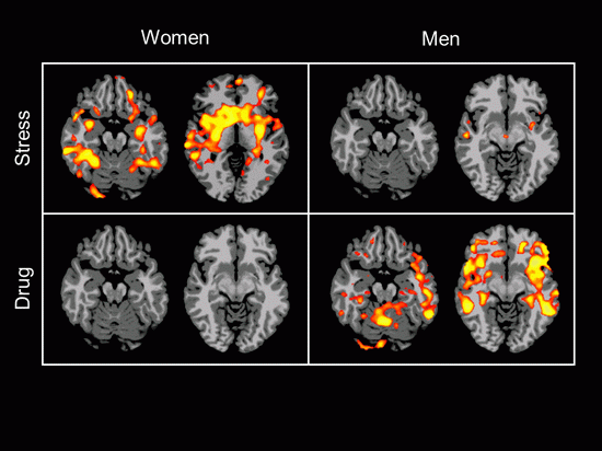male-vs-female-brain4.gif