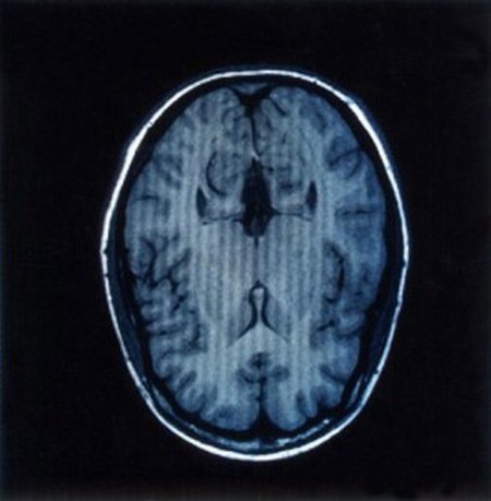 080305-brain-scan_big-294x300.JPG
