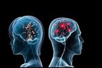 male-vs-female-brain0.jpg