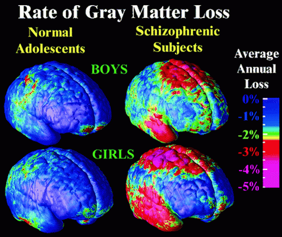 male-vs-female-brain3.gif