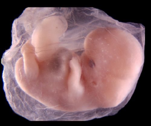 embryo_human_003.JPG